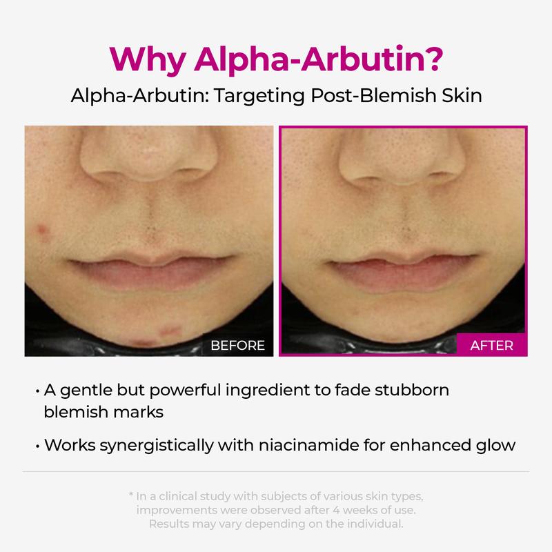 Dr. Melaxin Official Shop Lumi Pore & Spot Care Duo| Shrinks Pores & Fade Blemish Marks| Cyano Pink Spicule Serum + Picotonic Shot AmpouleContains Batteries or Cells?: None  
 Dangerous Goods or Hazardous Materials: None  
 Aerosols: No  
 Flammable Liquid: No  
 Container Type: Bottle  
 Region of Origin: Korea  
 Benefits: Improve Skin Texture, Firm Skin, Even Out Skin Tone, Brighten Dull Skin, Fade Blemish Marks, Minimize Pores, Pore Control, Soothing, Brightening, Hydration, Tighten, Moisturizing, Even Out Skin Tone & Texture  
 Shelf Life: 24 Months  
 Material Type Free: Alcohol Free  
 Product Form: Ampoule, Serum  
 Quantity Per Pack: 2  
 Age Group: ALL AGES  
 Skin Type: All Skin Types  
 Edition: Regular Edition  
 Pack Type: Multi-pack  
 Contains Alcohol or Aerosol: Contains Neither  
 Net Weight: 172  
 Ingredients: Alpha Arbutin, Hyaluronic Acid, Spicule, Pink Vitamin B12, Collagen Extract, Niacinamide  
 Manufacturer: COSMECCA KOREAML Clinic  for Wellness