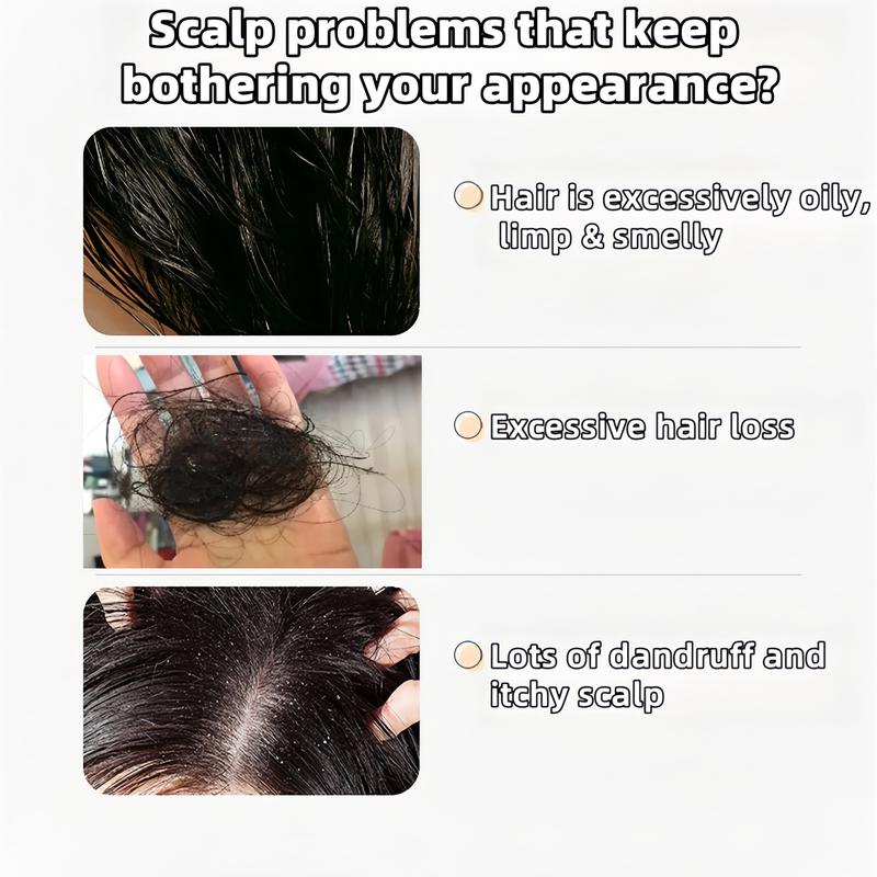 【Buy 1 Get 1 Free】REMIMPI Anti-Hair Fall Hair Loss Treatment Shampoo Oil Control Anti-Dandruff Haircare Ginseng Ginger Help Hair Growth Jojoba Oat Repair Reduce Hair Loss Scalp Cleanser Conditioner 300MLBenefits: Anti-dandruff, Anti-Hair Loss
Net Weight: 300g
Hair Type: Any
Benefits: Volumizing, Anti-dandruff, Hair Loss, Anti-thinning, Nourishing, Hair Growth
Shelf Life: 24 MonthsML Clinic  for Wellness