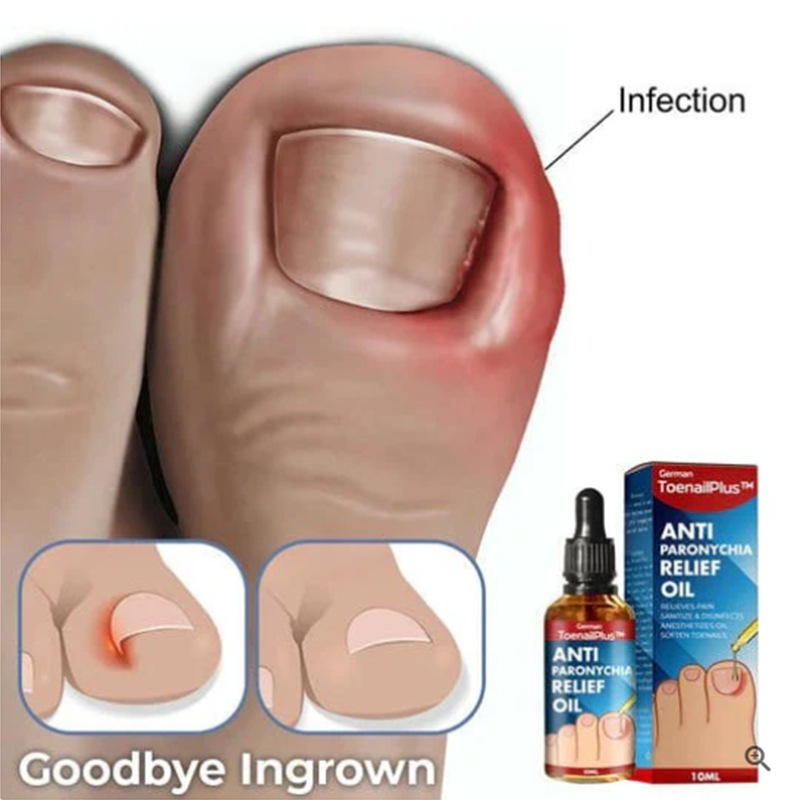 ToenailPlus Anti-Nail Groove Relief Oil Soft Nail Bright Nail Repair Ingrown Nail Thickening Nail Groove Care OilNail Groove Care OilBrand: ToenailPlus
Brand Type: OEM
Whether to import: No
Efficacy: Other
Specifications: Sample
Color classification: 10ml (for export sales only, domestic sales prohibited, purchase equals default disclaimer)
Main downstream platforms: AliExpress, Independent Station, Others
Whether cross-border export exclusive supplier: Yes
Special Purpose Cosmetics: No
Category: Body Care Set
Product name: Anti-Autoimmune Thyroid Relief OilNail Groove Care OilML Clinic  for Wellness