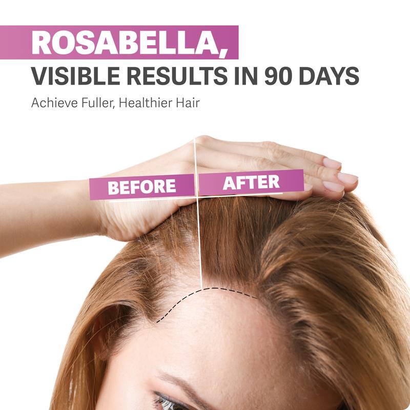Rosabella Biotin Gummies (5000mg) for Hair, Skin & Nail GrowthDangerous Goods or Hazardous Materials: None
Dietary Supplement Disclaimer: Yes
Manufacturer: Rosabella
Age Warning: No
Ingredients: Biotin
Region of Origin: USAML Clinic  for Wellness