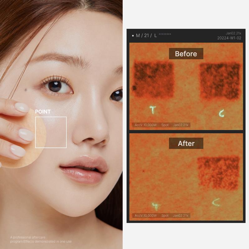 [Medicube Official] Red Succinic Acid Panthenol Pads|  Niacinamide + Salicylic Acid SkincareContains Batteries or Cells?: None 
 
 Dangerous Goods or Hazardous Materials: None 
 
 Aerosols: No 
 
 Flammable Liquid: No 
 
 Region of Origin: Korea 
 
 Benefits: Acne Care, Soothing, Dirt Removal, Hydration, Moisturizing 
 
 Shelf Life: 12 Months 
 
  Skin Type: Normal, Combination, Oily, Acne Prone, Sensitive, All Skin Types 
 
 Edition: Regular Edition 
 
 Net Weight: 181 
 
 Ingredients: Water, Butylene Glycol, Propanediol, Niacinamide, 1,2-Hexanediol, Alcohol, Panthenol, Succinic Acid, Glycerin, Polyglyceryl-10  Laurate, Polyglycerin-3, Thromethamine, Allantoin, Salicylic Acid, Vinyl Dimethicone, Ethylhexylglycerin, Coptis Japan root Extract, Xanthan Gum, Disodium EDTA, Cyanocobalamin, Hydrogenated lecithin, peppermint Piperita (Peppermint) Oil, Citrus Aurantium Bergamia (Bergamot) fruit Oil, Rosemary Officinalis (Rosemary) leaf Oil, Protease, Juniperus Virginiana Oil, Lavender Hybrid Oil, Elettaria Cardamomum seed Extract, Foeniculum Vulgare (Fennel) seed Extract, Crocus Sativus flower Extract, Coriander Sativum (Coriander) Extract, Tocopherol 
 
 Manufacturer: ANCORSML Clinic  for Wellness