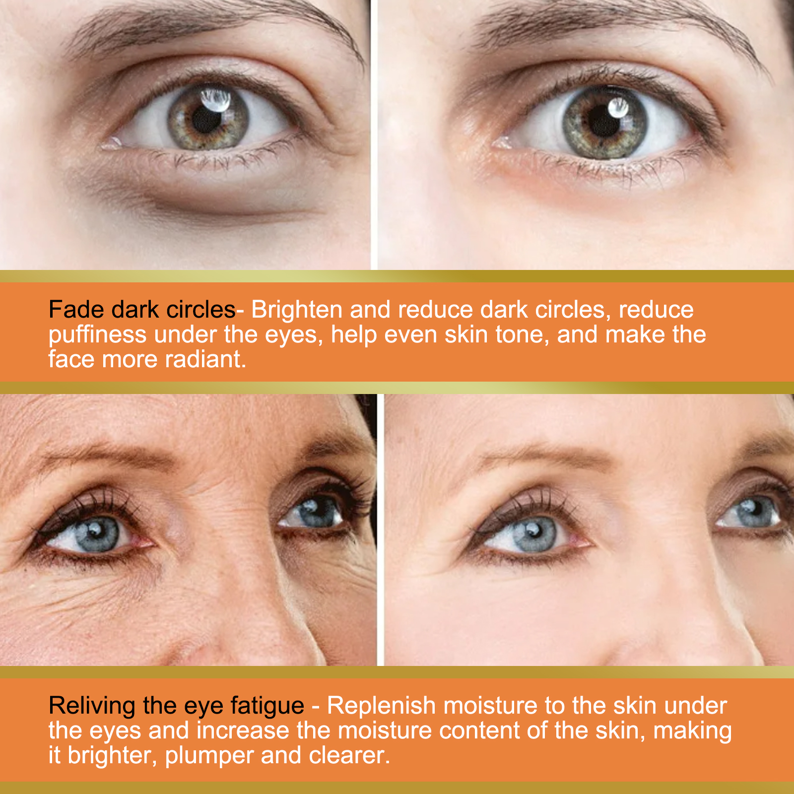 EELHOE Vitamin C Eye Cream Stick Dark Circles Repair Moisturizing Firming Eye Cream StickEye CreamNet content: 4g  
 Product name: Vitamin C eye cream stick  
 Keywords: Reduce Fine Lines, Eye Care  
 Gross weight: 19g  
 Ingredients: Glycerin Stearate, Carbomer, Ascorbic Acid (Vitamin C)  
 Packaging size: 2*2*7.7cm  
 Product size: 1.7*7.4cm  
 Box size: 56*36*21.5cm  
 Packing quantity: 900 pieces  
 Weight of one box: 17.85kg  
 Shelf life: 3 years  
 Storage method: Please store in a cool and shaded placeEye CreamML Clinic  for Wellness