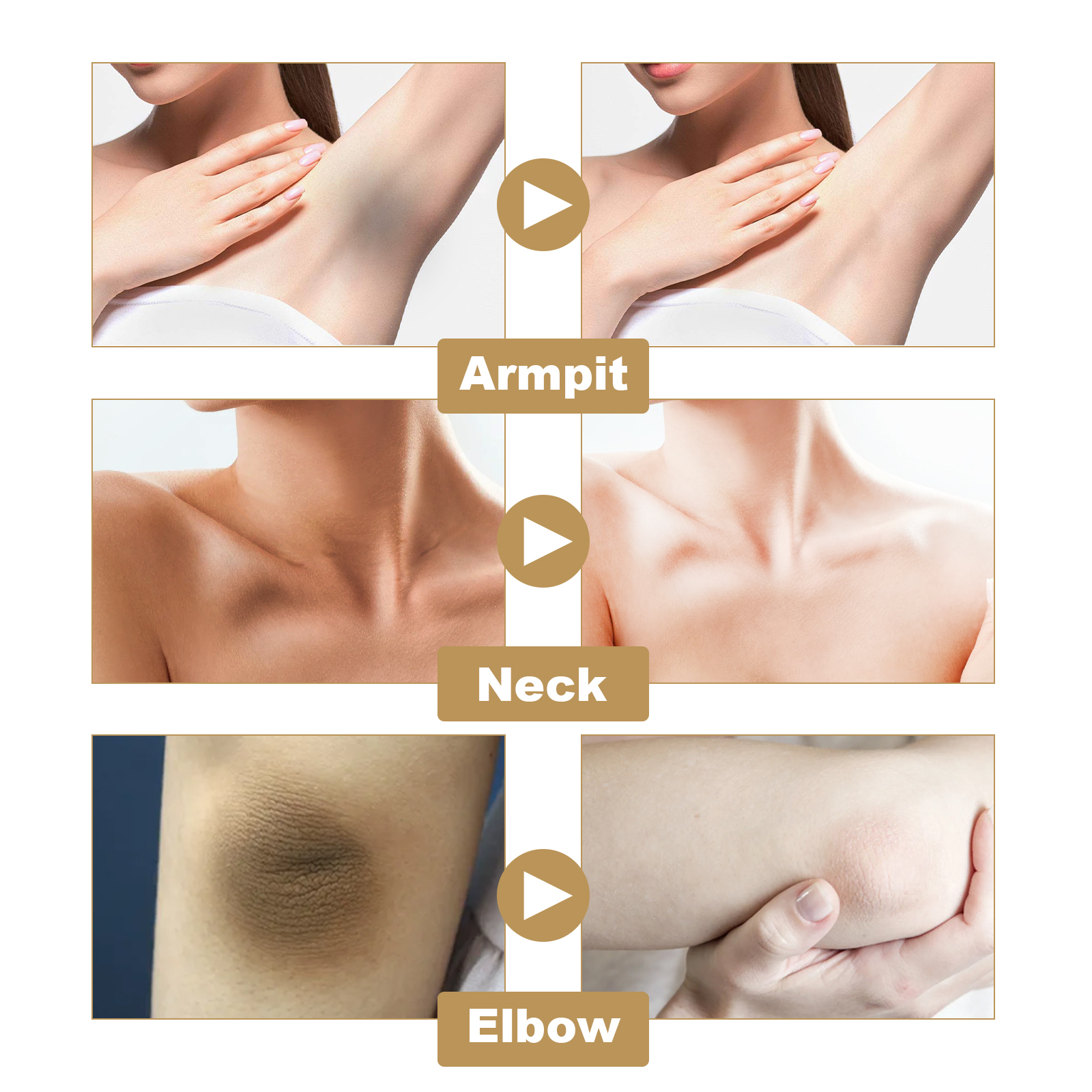 Body Whitening Cream Dark Spot Removal Whitening Hydrating Beauty CreamBody Whitening CreamNet content: 100g  
 Product name: Body Whitening Cream  
 Keywords: Brightening Skin Tone  
 Gross weight: 136g  
 Ingredients: Aloe Vera, Retinol, Niacinamide  
 Packaging size: 7.3*7.3*4.6cm  
 Product size: 7*4.3cm  
 Box size: 56*36*21.5cm  
 Packing quantity: 200 pieces  
 One box weight: 27.95kgBody Whitening CreamML Clinic  for Wellness