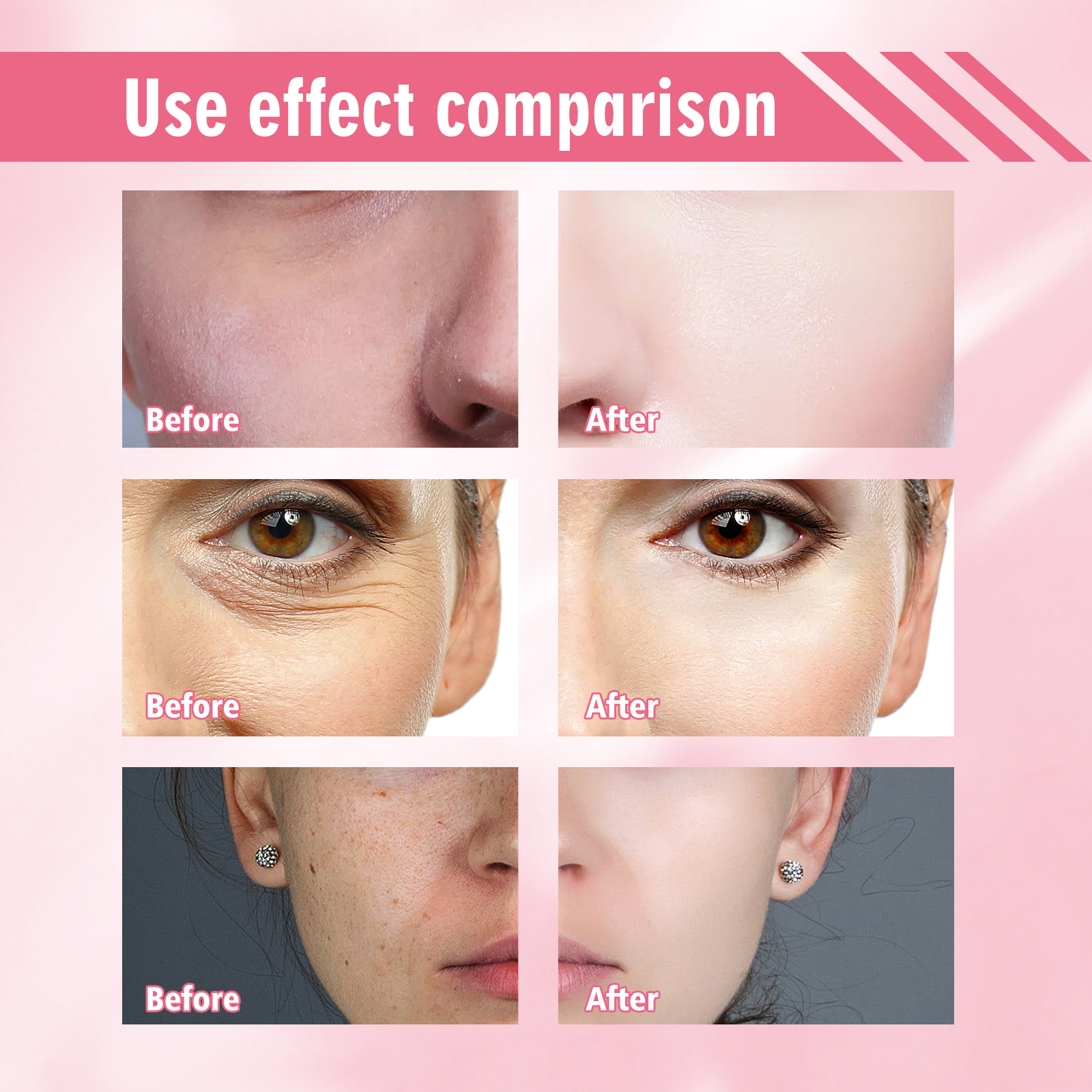 Jaysuing Lightening Spot Whitening Essence Moisturizing Dark Spot Removal Lightening Wrinkle Brightening Skin EssenceBrightening Skin EssenceNet content: 15ml  
 Product name: Spot-fading and Whitening Essence  
 Keywords: Brighten skin, remove dark spots  
 Gross weight: 30g  
 Ingredients: Astaxanthin, blood extract, red apple extract  
 Packaging size: 9*2.6*2.6cm  
 Product size: 8.7*2.3cm  
 Box size: 56*36*21.5cm  
 Packing quantity: 363 pieces  
 Weight of one box: 16.35kgBrightening Skin EssenceML Clinic  for Wellness