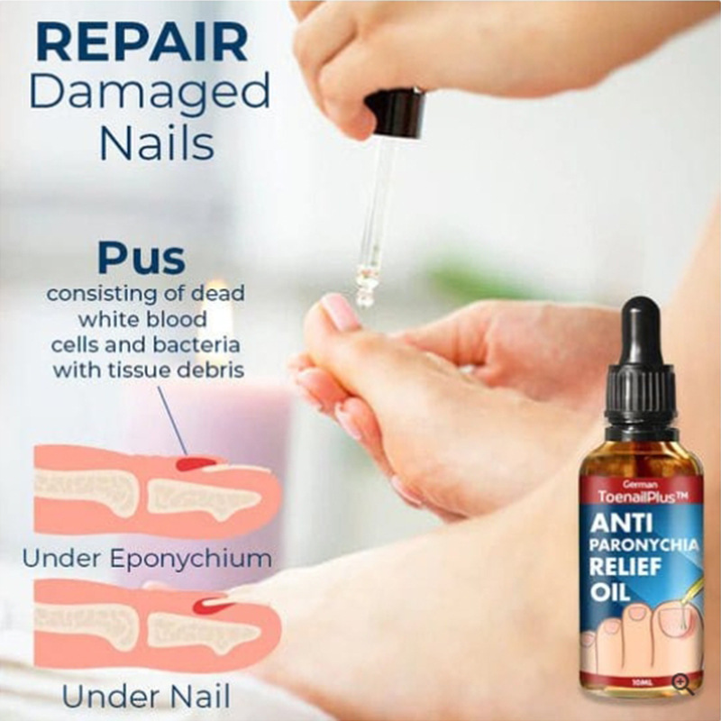 ToenailPlus Anti-Nail Groove Relief Oil Soft Nail Bright Nail Repair Ingrown Nail Thickening Nail Groove Care OilNail Groove Care OilNail Groove Care OilML Clinic  for Wellness